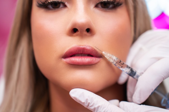 D Cosmetische Beauty Specialist In Fillers En Botox FillerHouse