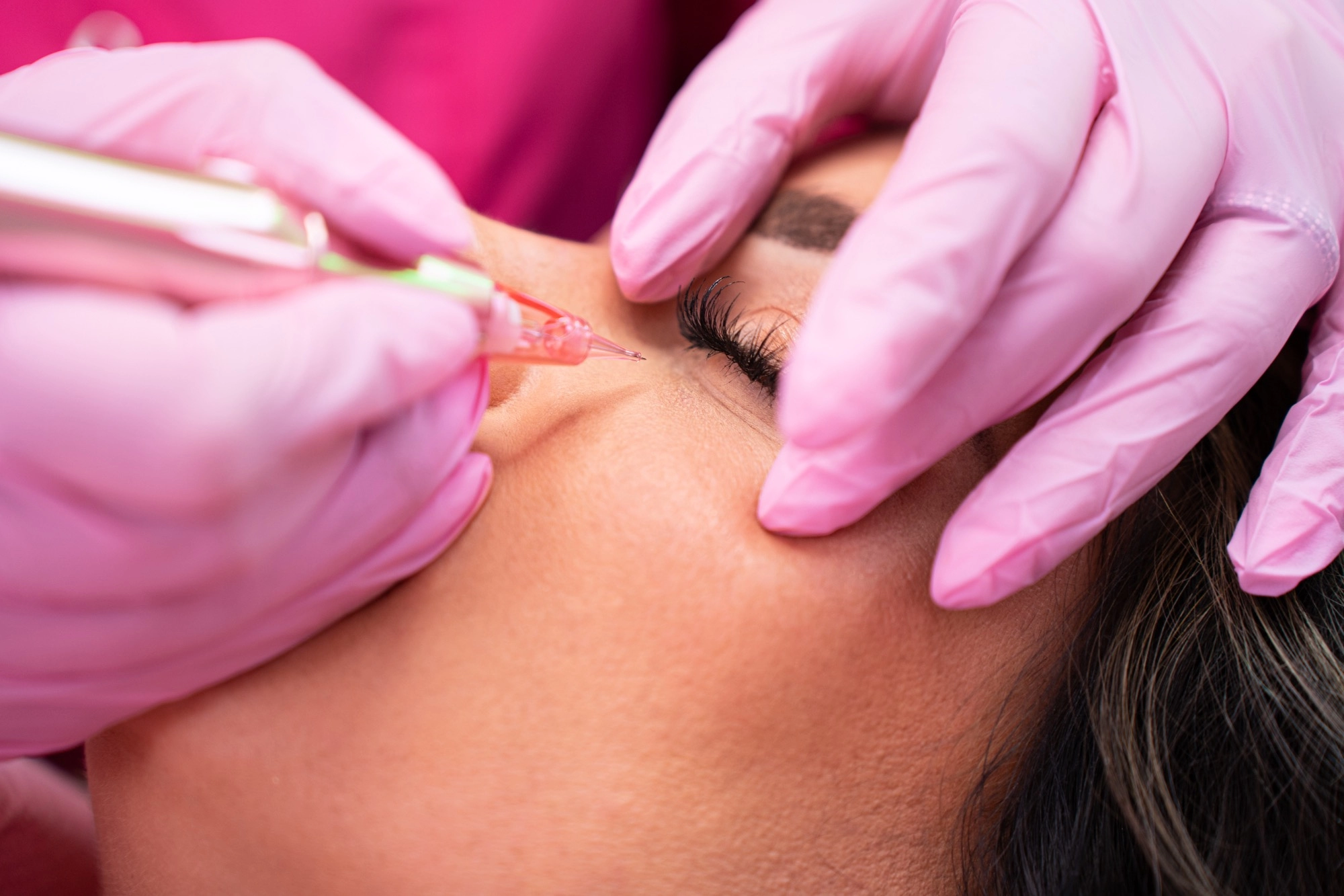 Remove under-eye bags with the Lumi Eyes treatment