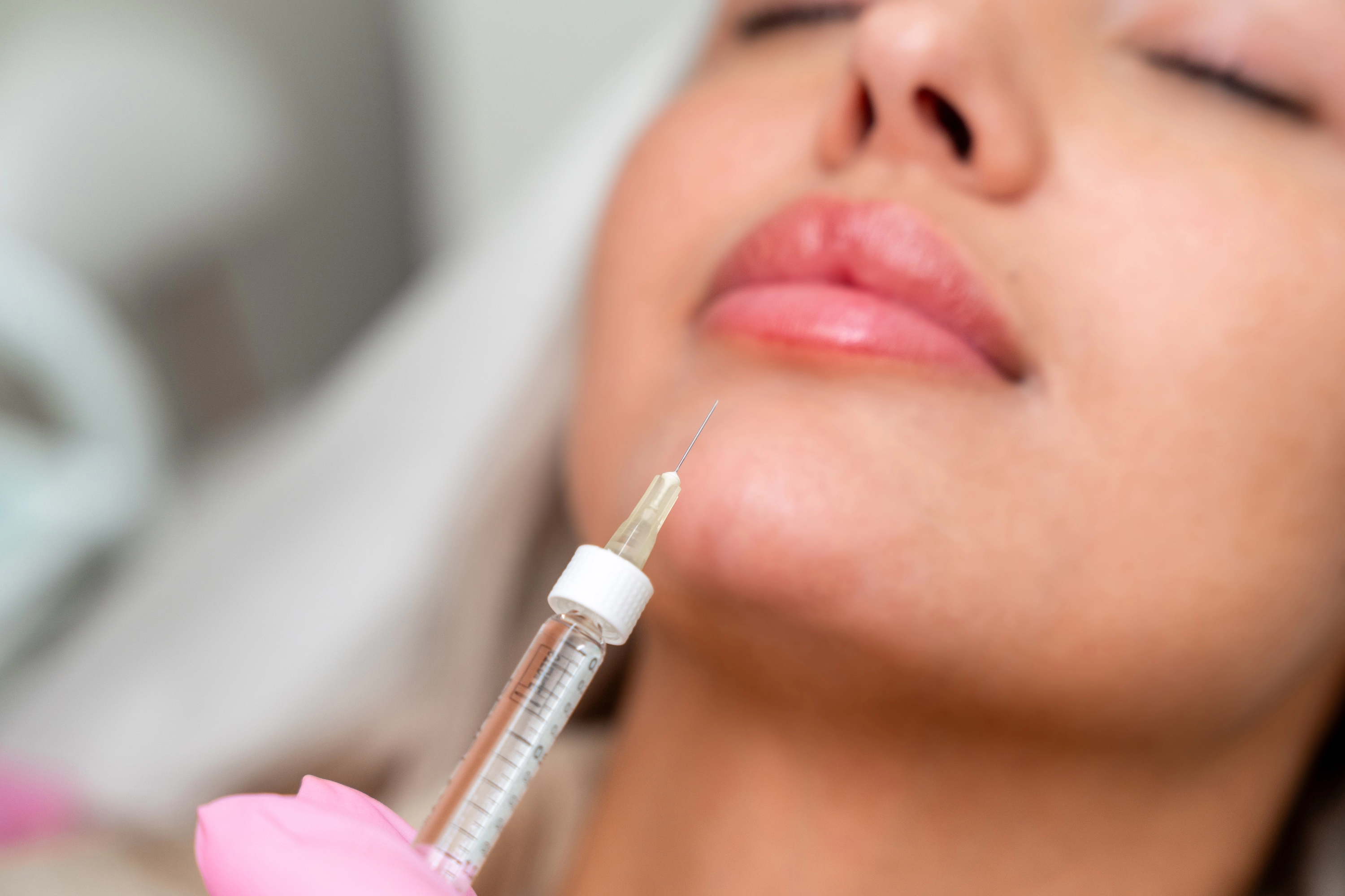 skinbooster behandelingen